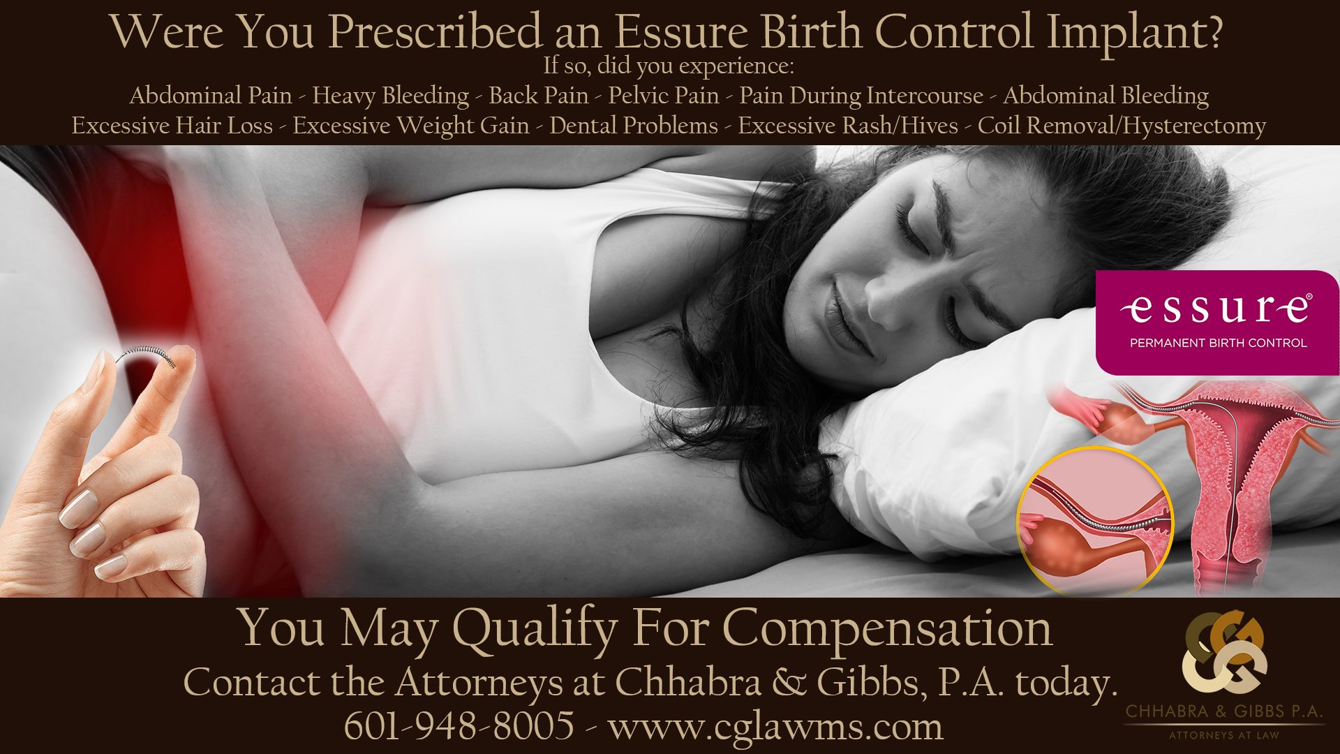 Essure - Fetal - officially