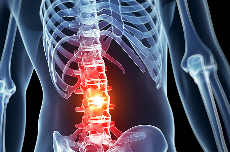 Spinal Cord Injury Attorney