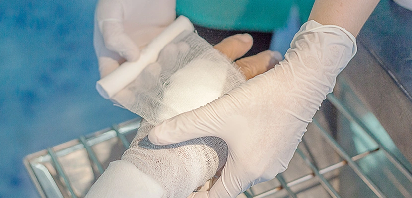 Mississippi Burn Injury Lawyer-image
