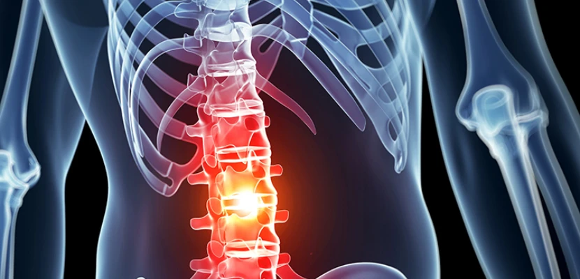 Mississippi Abogado especializado en lesiones medulares-imagen