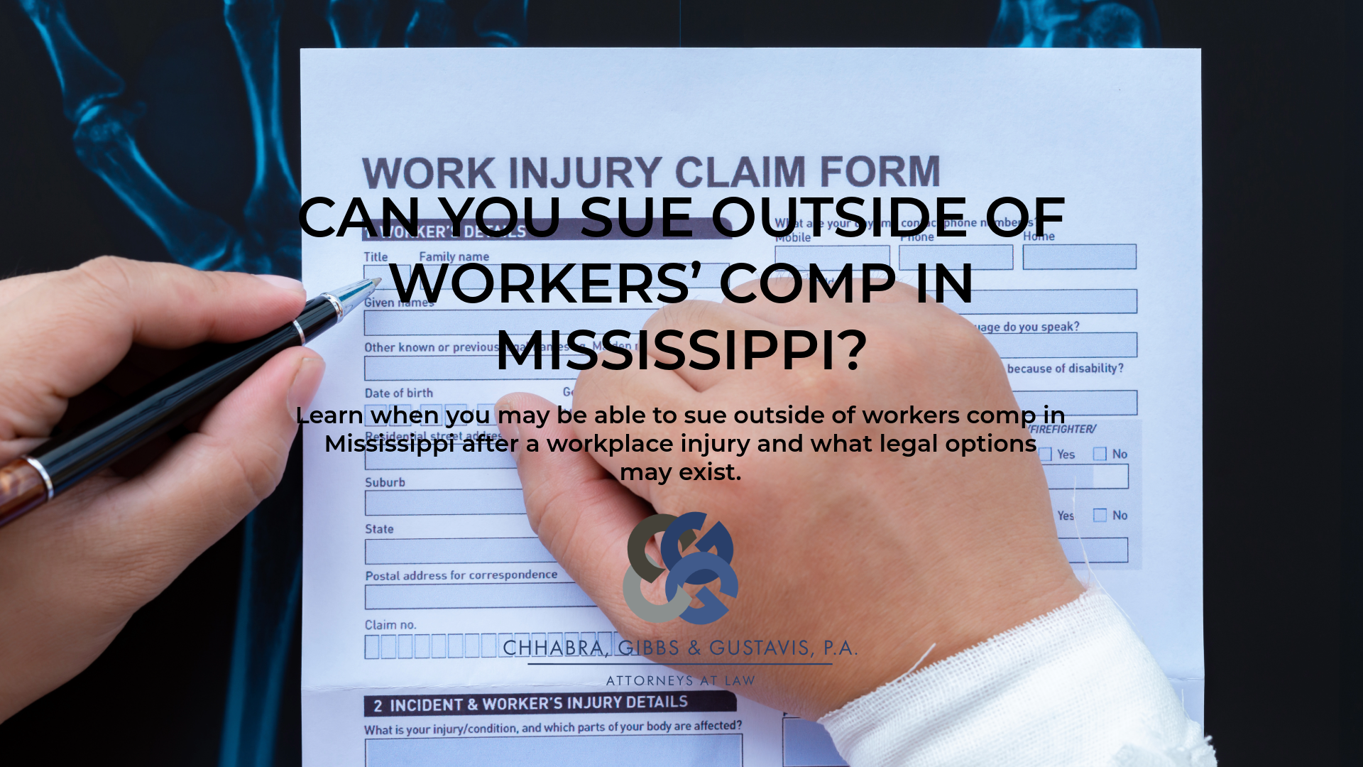 ¿Se puede presentar una demanda fuera del ámbito de la indemnización laboral en Mississippi?